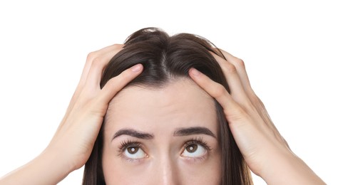 Photo of Young woman with hair loss problem on white background, closeup