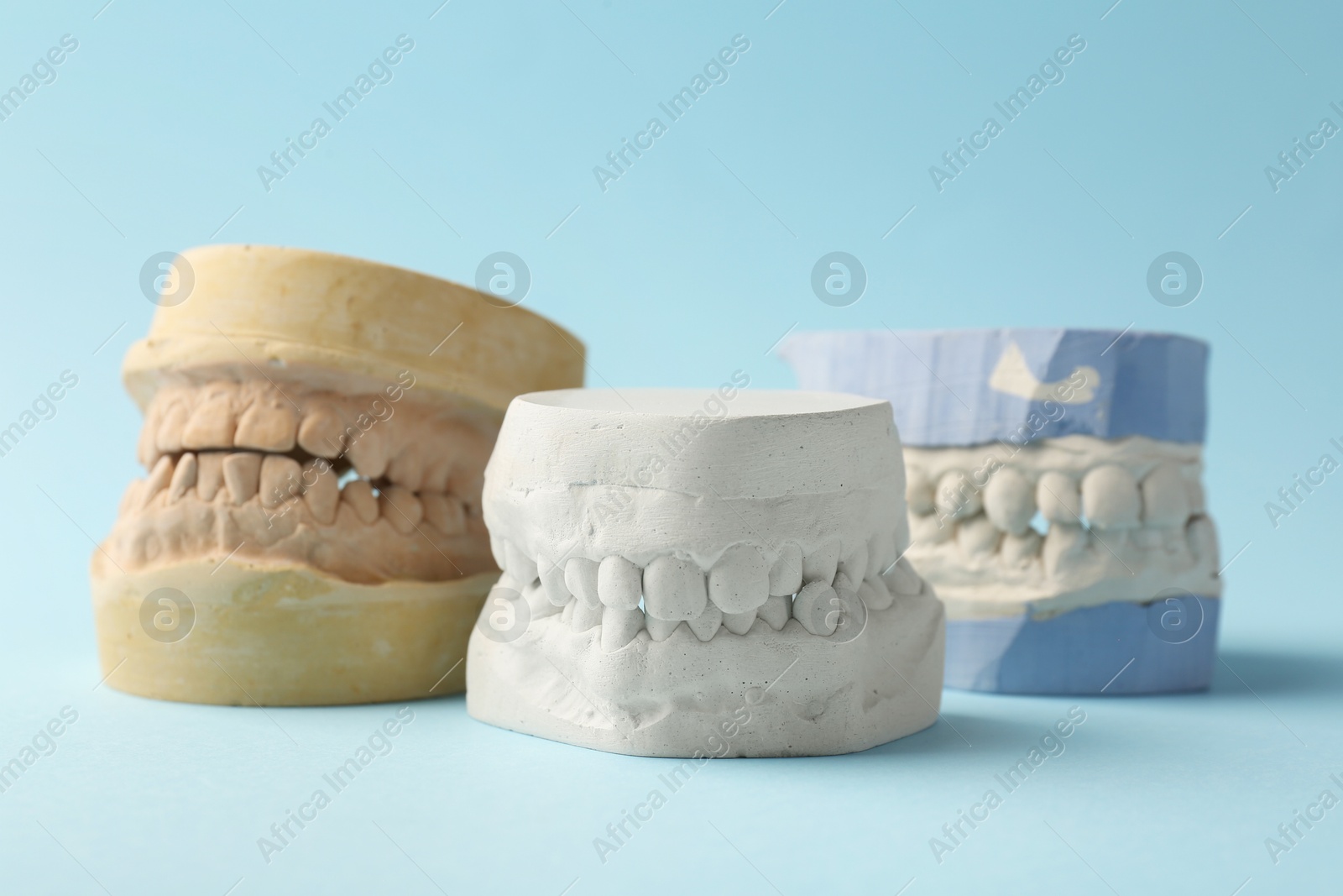 Photo of Dental models with gums on light blue background, closeup. Cast of teeth