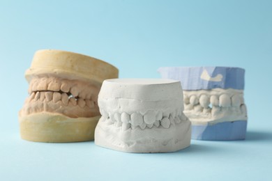 Dental models with gums on light blue background, closeup. Cast of teeth