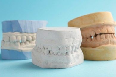 Photo of Dental models with gums on light blue background, closeup. Cast of teeth