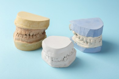 Photo of Dental models with gums on light blue background. Cast of teeth