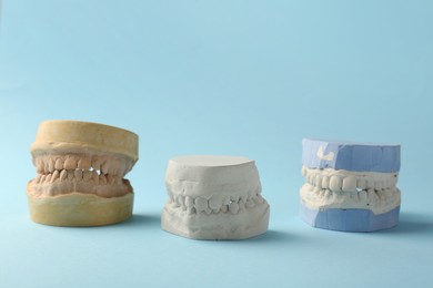 Photo of Dental models with gums on light blue background. Cast of teeth