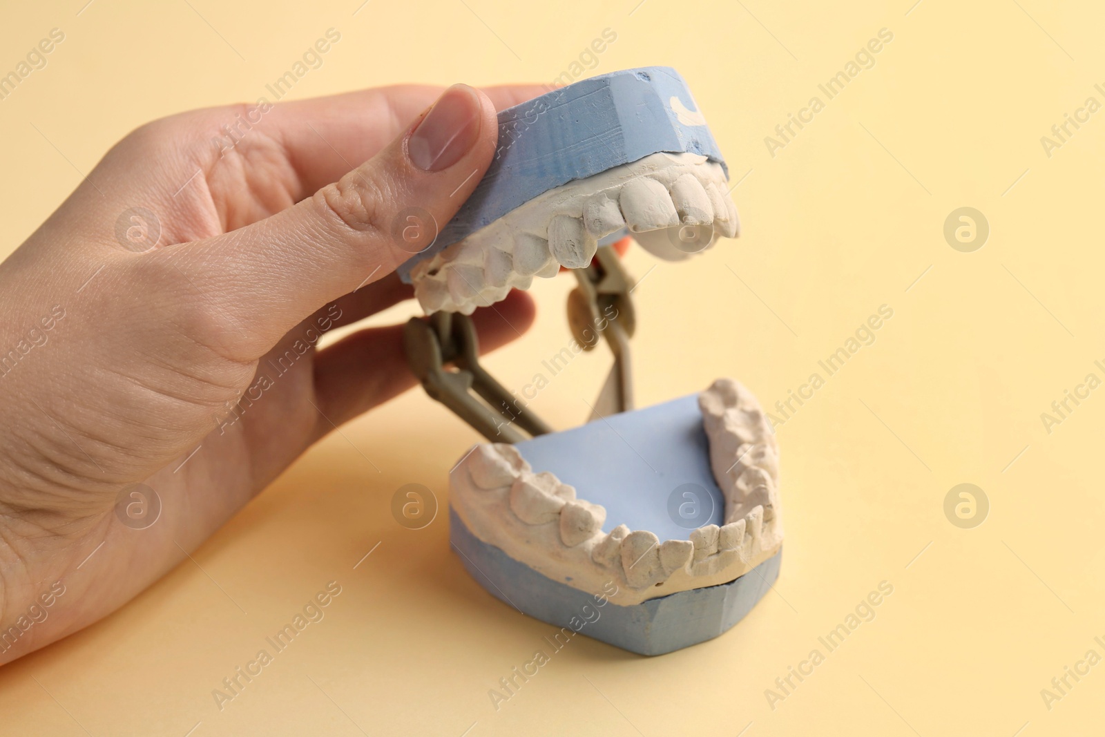 Photo of Woman holding dental model with gums on yellow background, closeup. Cast of teeth