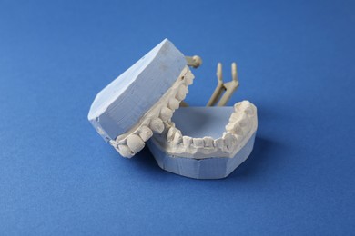 Photo of Dental model with gums on blue background. Cast of teeth