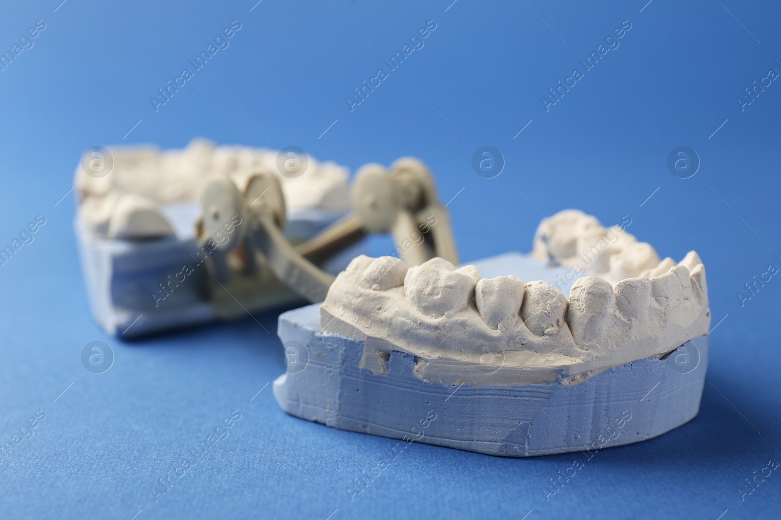Photo of Dental model with gums on blue background, closeup. Cast of teeth