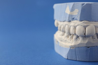 Dental model with gums on blue background, closeup and space for text. Cast of teeth