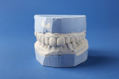 Dental model with gums on blue background. Cast of teeth