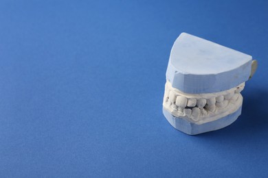 Photo of Dental model with gums on blue background, space for text. Cast of teeth