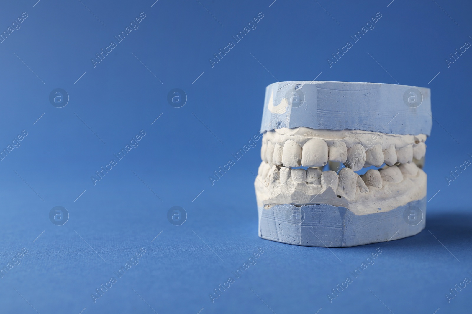 Photo of Dental model with gums on blue background, space for text. Cast of teeth