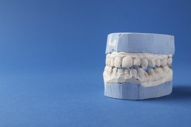 Dental model with gums on blue background, space for text. Cast of teeth