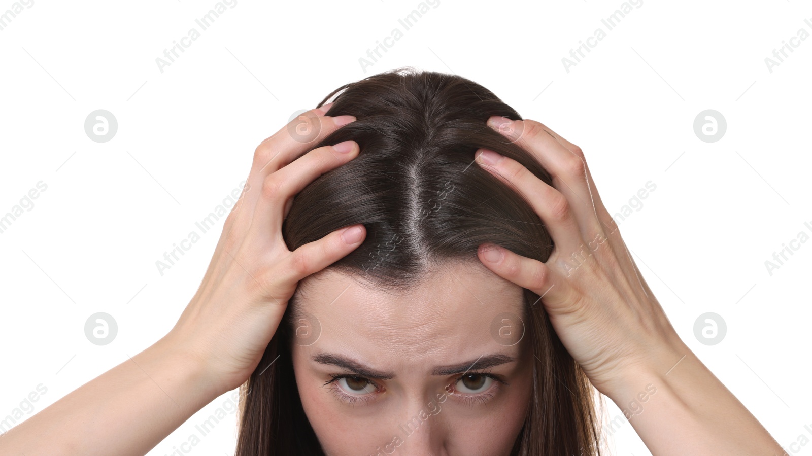 Photo of Young woman with hair loss problem on white background, closeup