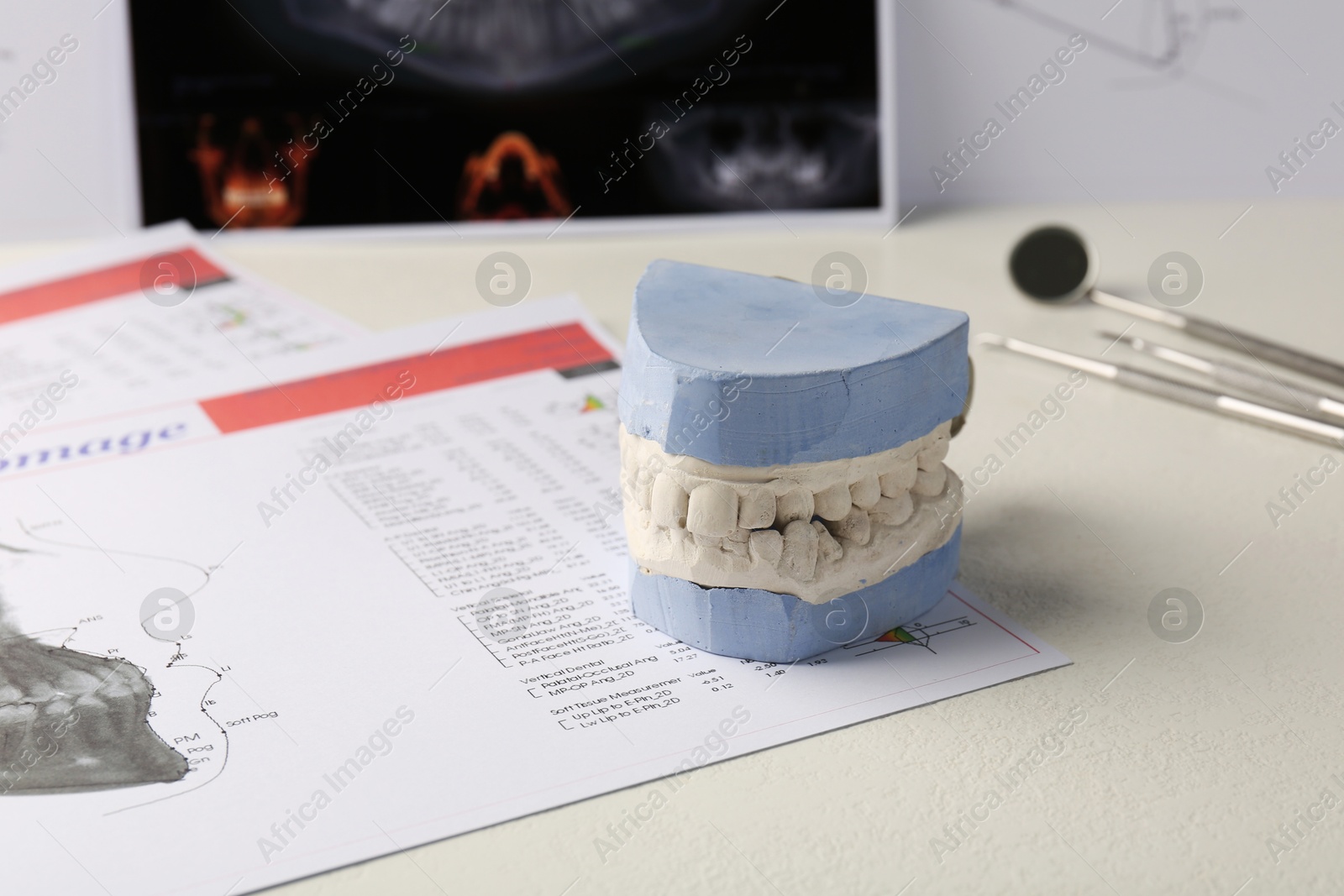 Photo of Dental model with gums, anatomy charts and panoramic x-ray on table. Cast of teeth