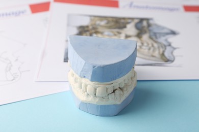 Photo of Dental model with gums and anatomy charts on light blue background, closeup. Cast of teeth