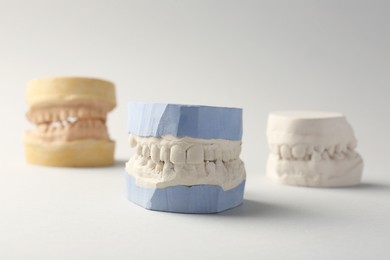 Photo of Dental models with gums on gray background. Cast of teeth
