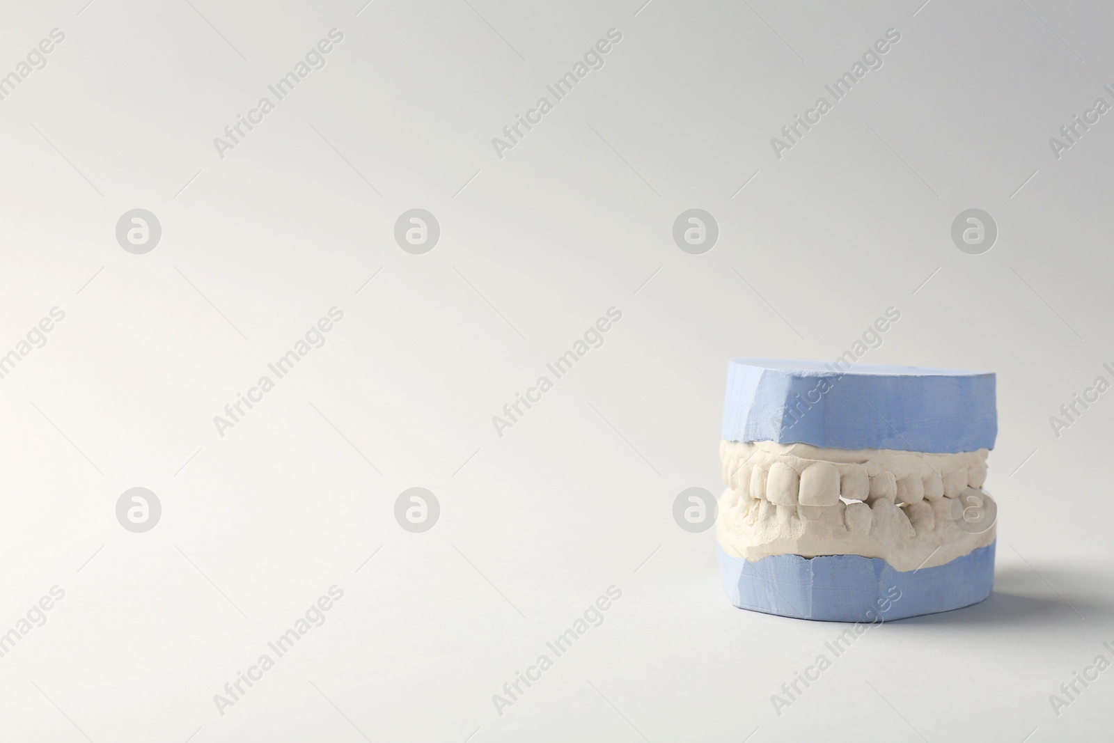 Photo of Dental model with gums on gray background, space for text. Cast of teeth