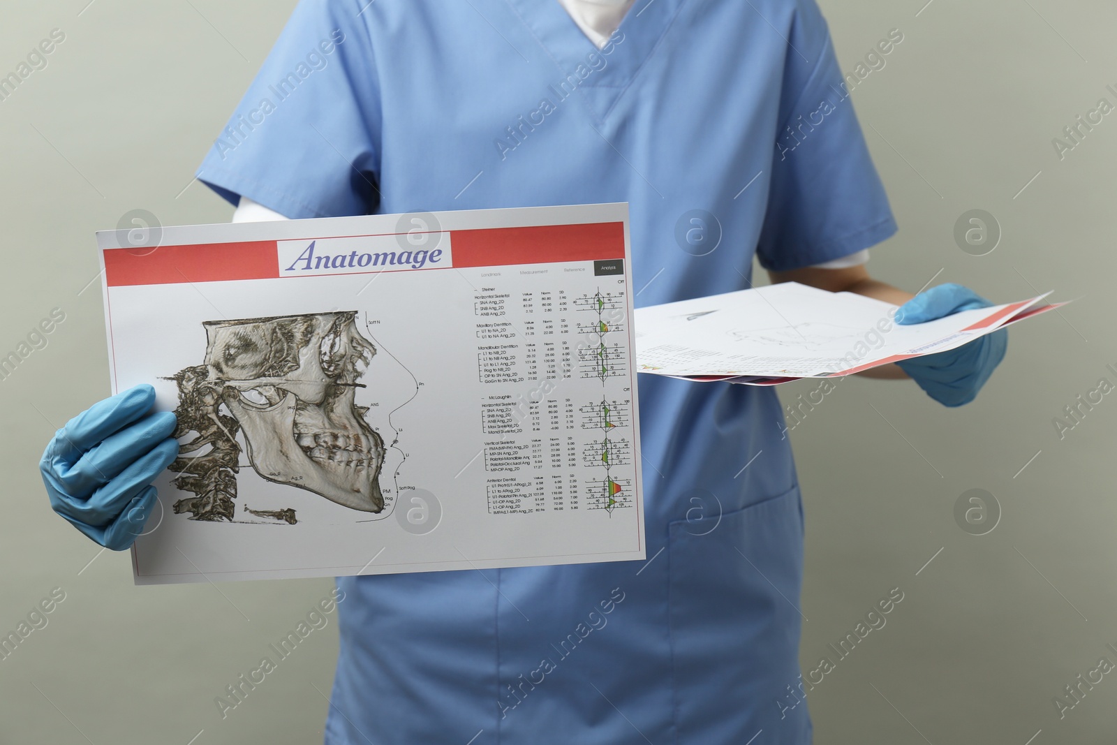 Photo of Doctor with visualization of human maxillofacial section for dental analysis printed on papers against grey background, closeup. Cast of teeth