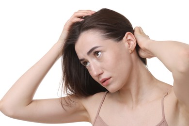 Young woman with hair loss problem on white background