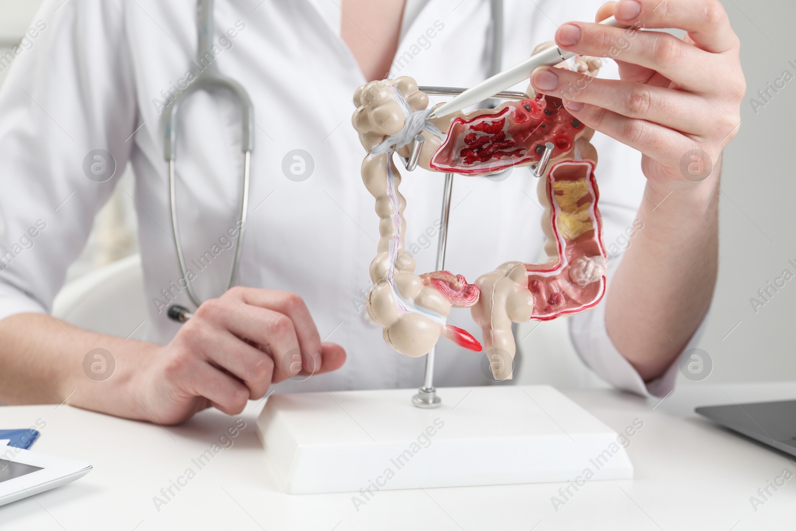 Photo of Doctor showing model of large intestine at white table in clinic, closeup