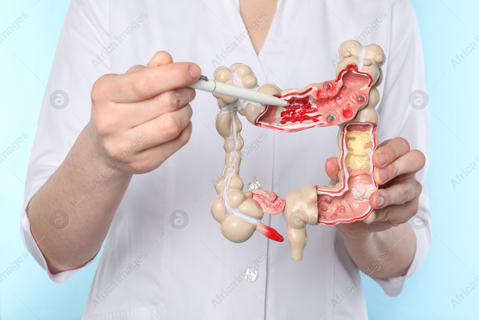 Photo of Doctor showing model of large intestine on light blue background, closeup