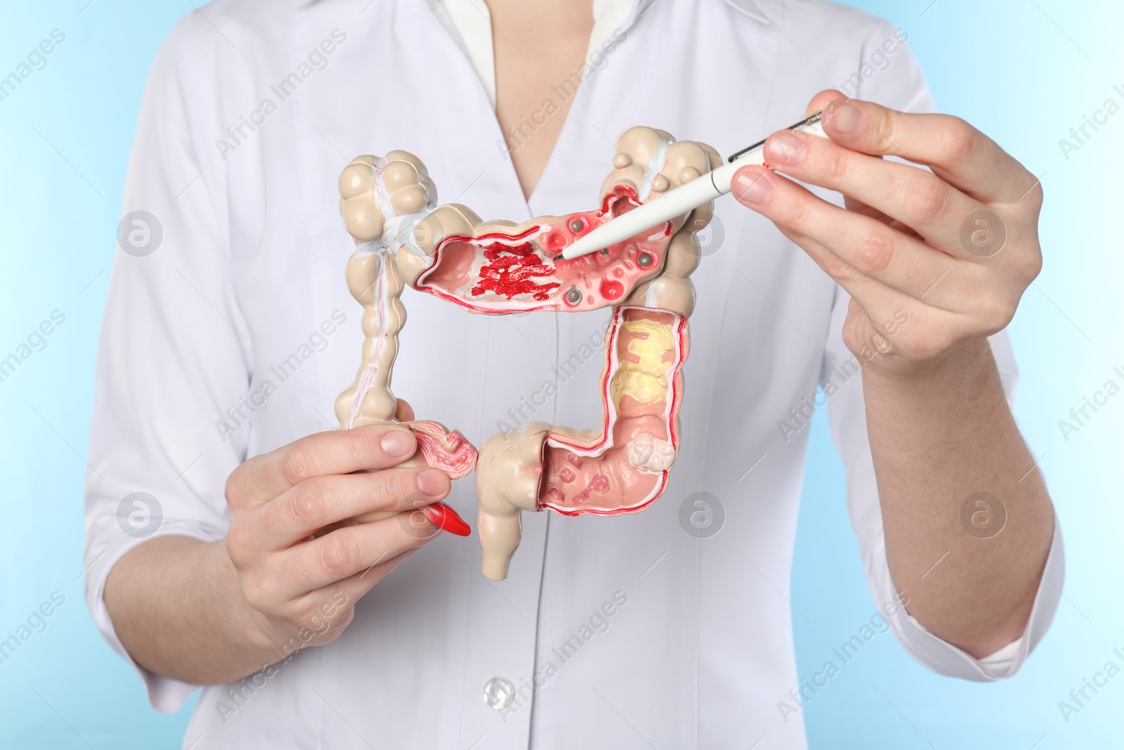 Photo of Doctor showing model of large intestine on light blue background, closeup