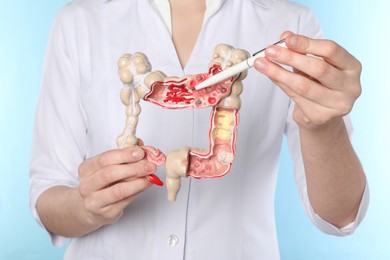 Doctor showing model of large intestine on light blue background, closeup