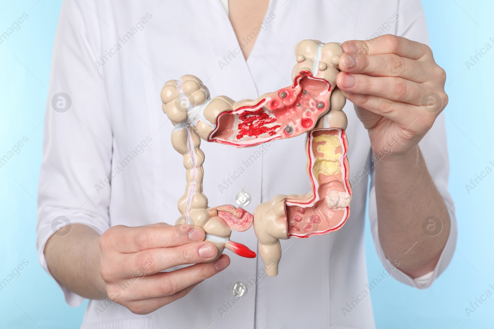 Photo of Doctor with model of large intestine on light blue background, closeup