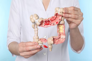 Photo of Doctor with model of large intestine on light blue background, closeup