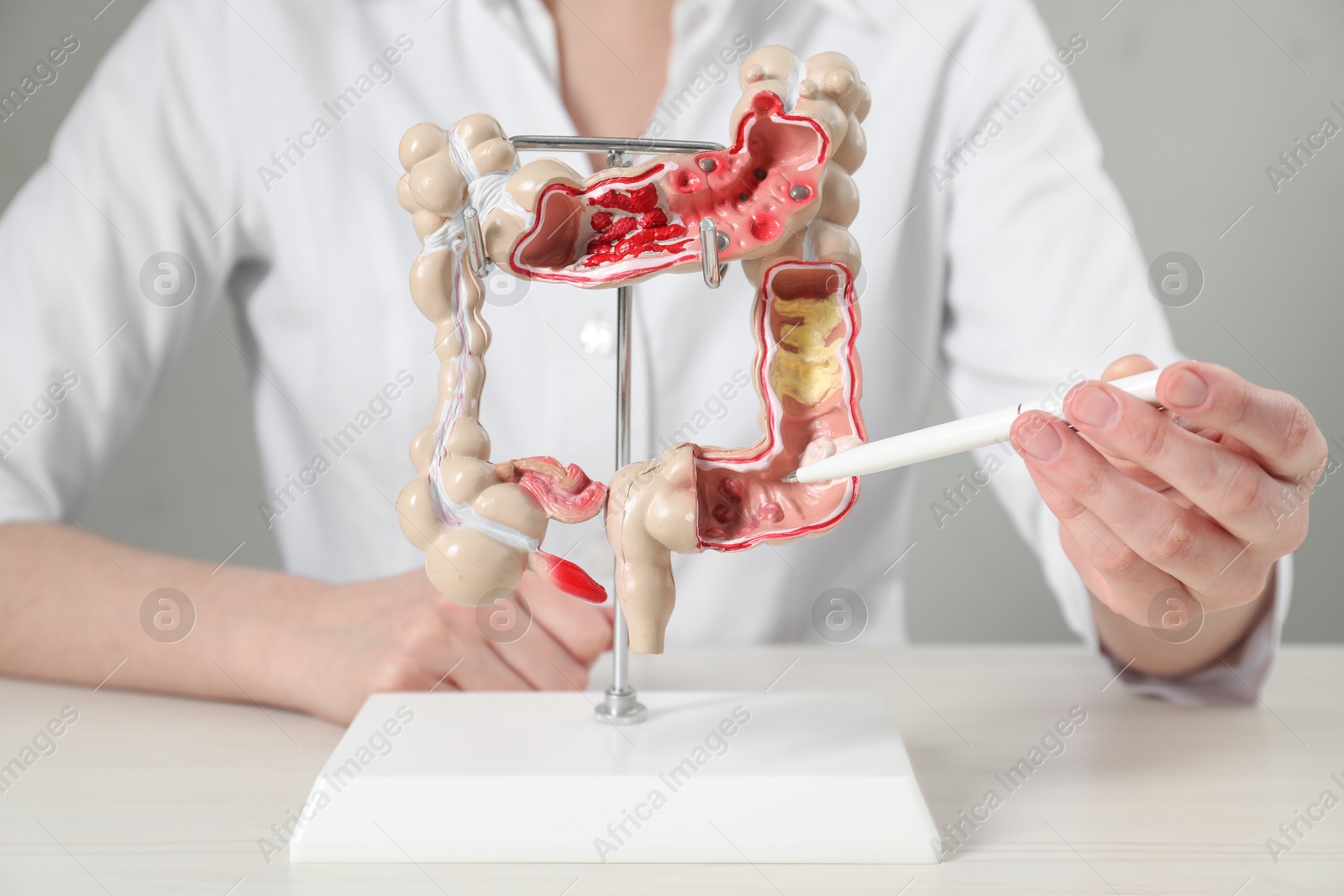 Photo of Doctor showing model of large intestine at table, closeup