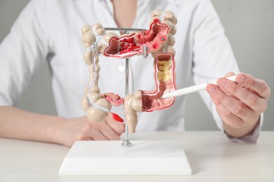 Photo of Doctor showing model of large intestine at table, closeup