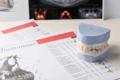Photo of Dental model with gums, anatomy charts and panoramic x-ray on table. Cast of teeth