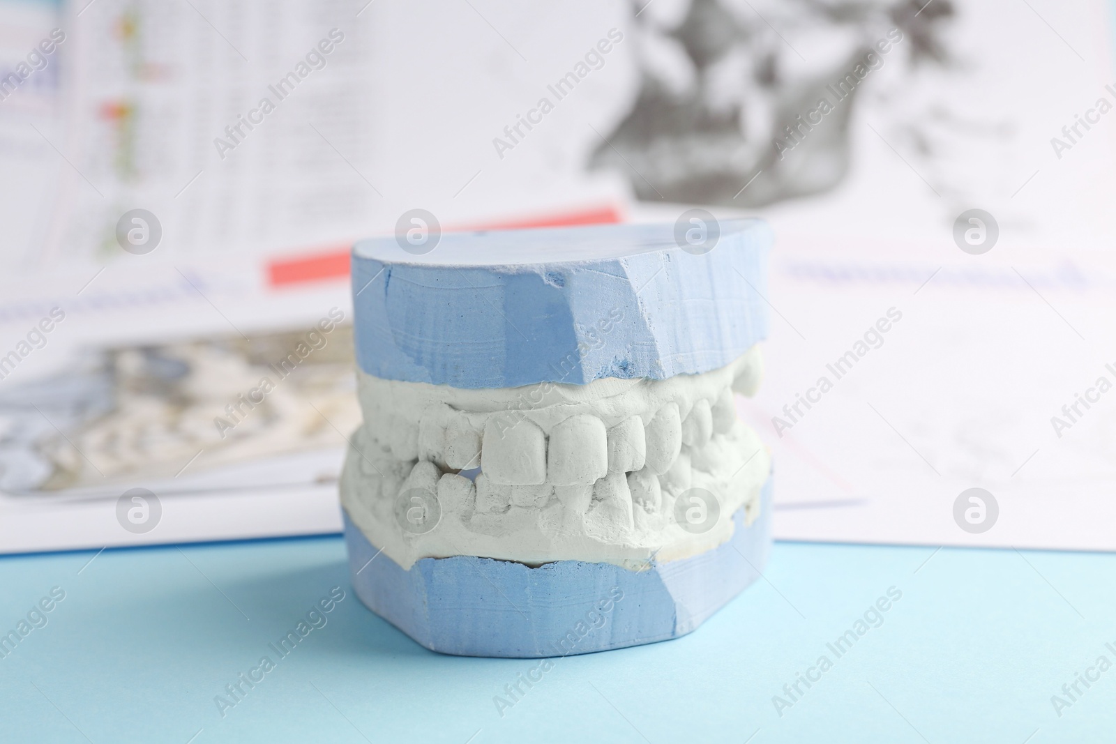 Photo of Dental model with gums and anatomy charts on light blue background, closeup. Cast of teeth