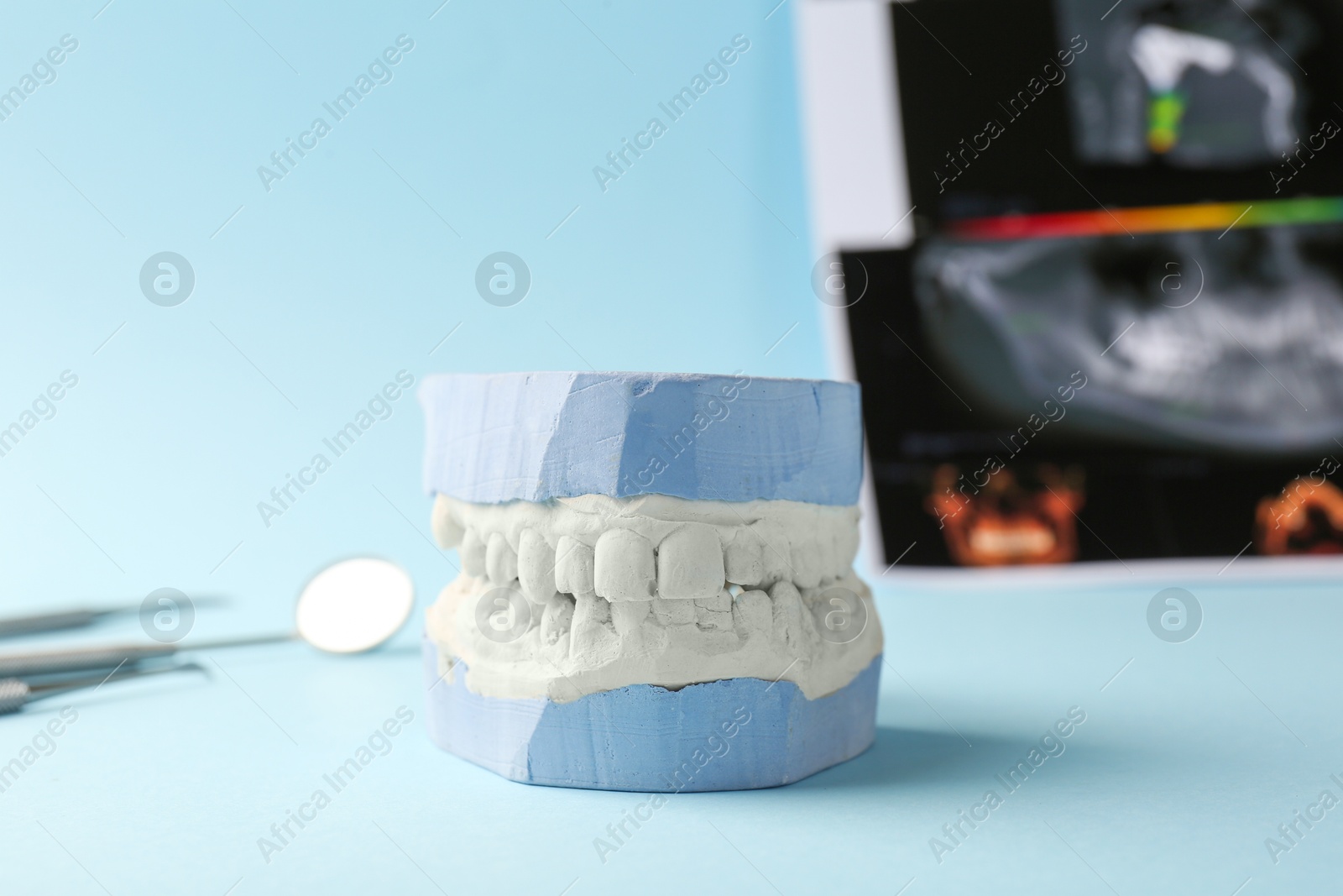 Photo of Dental model with gums, panoramic x-ray and dentist tools on light blue background. Cast of teeth