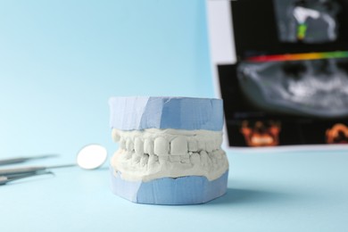 Dental model with gums, panoramic x-ray and dentist tools on light blue background. Cast of teeth