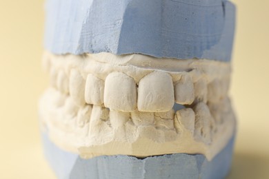 Dental model with gums on yellow background, closeup. Cast of teeth