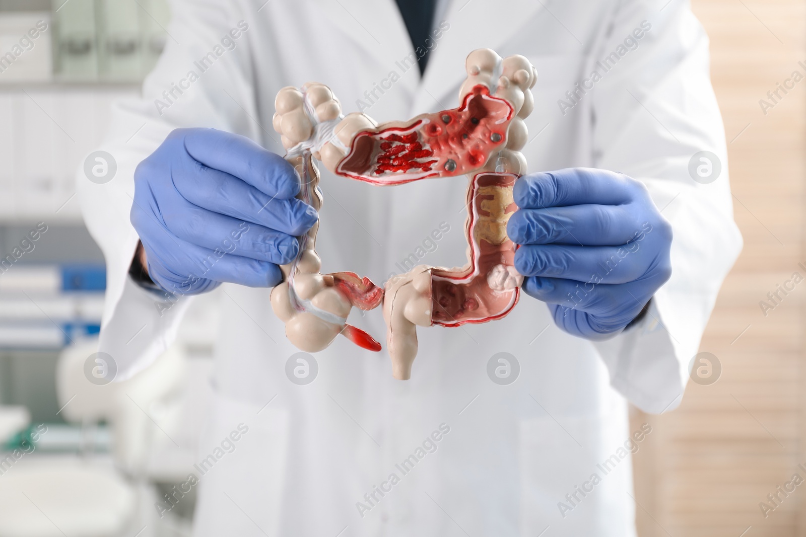 Photo of Doctor with model of large intestine in clinic, selective focus