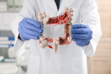 Doctor with model of large intestine in clinic, selective focus