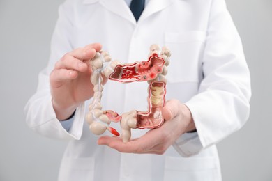 Photo of Doctor with model of large intestine on grey background, closeup