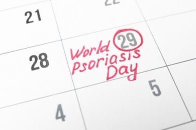 International Psoriasis Day. Calendar page with marked date as background, closeup