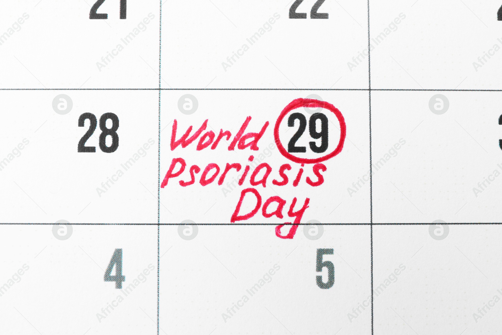 Photo of International Psoriasis Day. Calendar page with marked date as background, top view