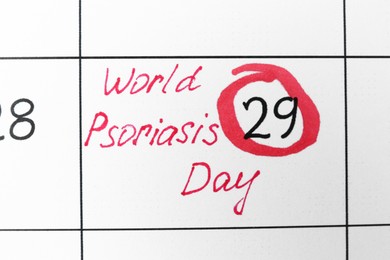 Photo of International Psoriasis Day. Calendar page with marked date as background, top view