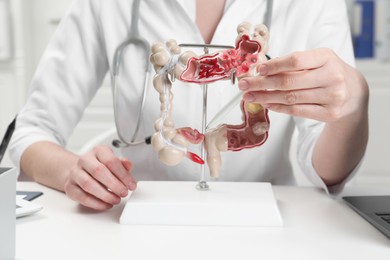 Photo of Doctor showing model of large intestine at white table in clinic, closeup