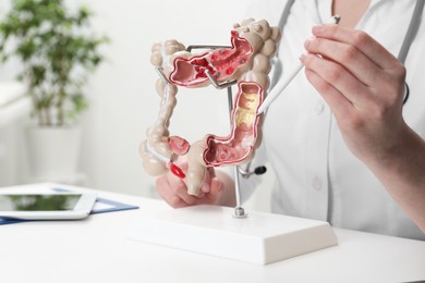Doctor showing model of large intestine at white table in clinic, closeup