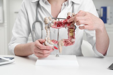 Doctor showing model of large intestine at white table in clinic, closeup