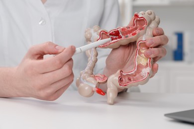 Photo of Doctor showing model of large intestine at white table in clinic, closeup