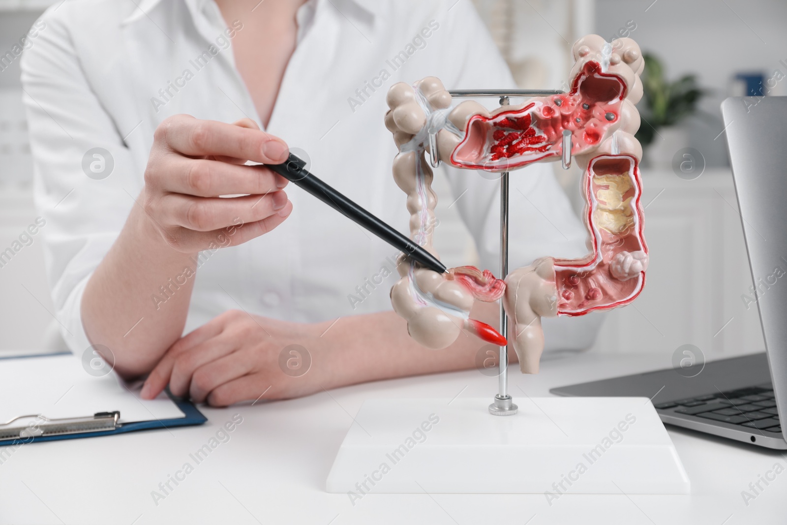 Photo of Doctor showing model of large intestine at white table in clinic, closeup