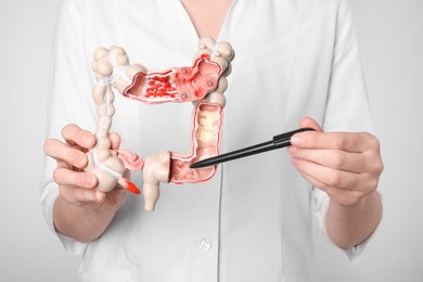 Doctor showing model of large intestine on light grey background, closeup