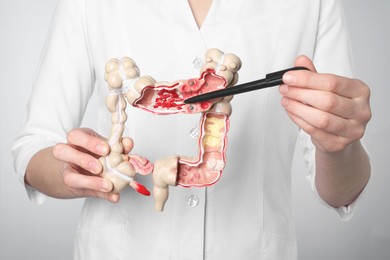 Photo of Doctor showing model of large intestine on light grey background, closeup