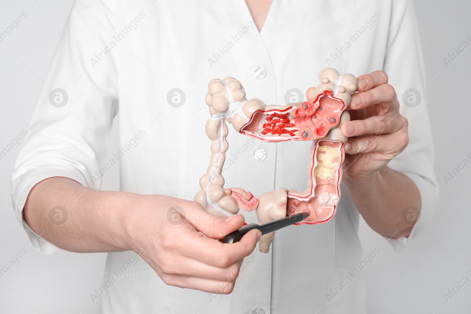 Photo of Doctor with model of large intestine on light grey background, closeup