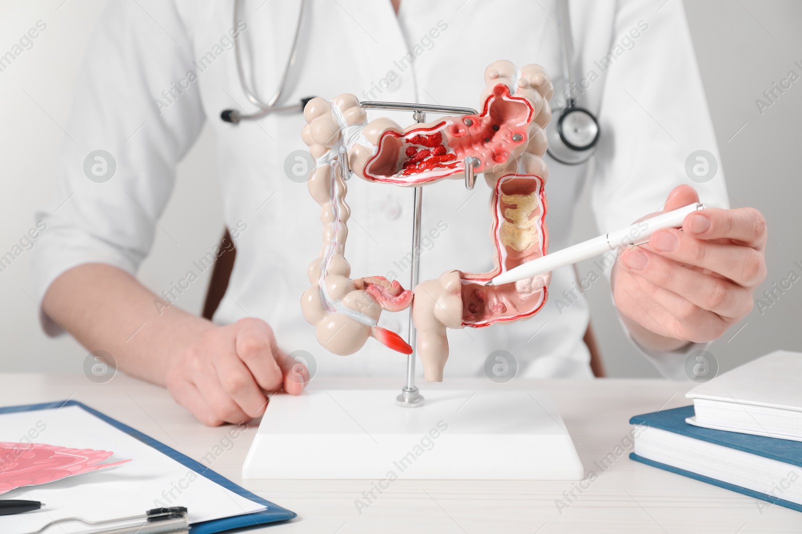 Photo of Doctor showing model of large intestine at table, closeup