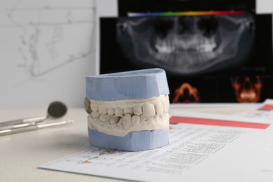 Photo of Dental model with gums, anatomy charts and panoramic x-ray on table. Cast of teeth